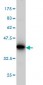 ITM1 Antibody (monoclonal) (M02)